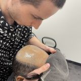 Hair Replacement | Hair Systems | Toupees | Wigs | Hair Toppers for Men and Women 